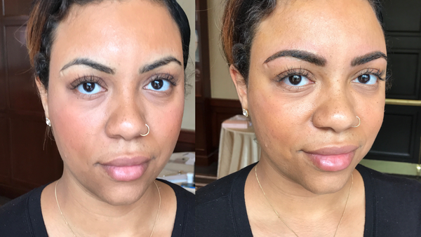 Case Study 5: The secret to flawless healed results